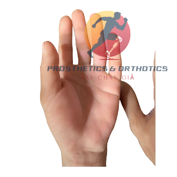 Tay thẩm mỹ làm theo khuôn